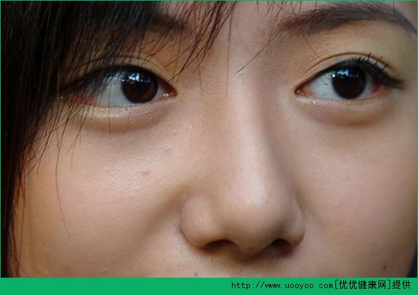 明星為什麼要整容？揭秘整容背後的故事(2)