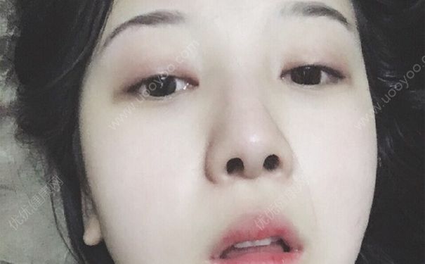 BB霜用什麼卸妝?BB霜卸妝水能卸幹凈嗎?(2)