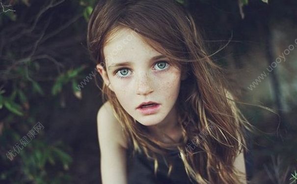 雀斑會自己消失嗎？雀斑會自己淡化嗎？(2)