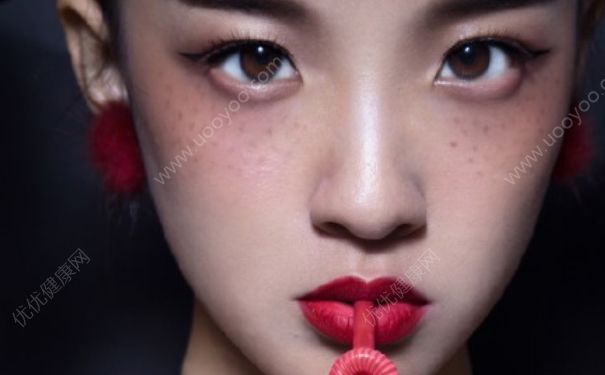 雀斑會自己消失嗎？雀斑會自己淡化嗎？(4)