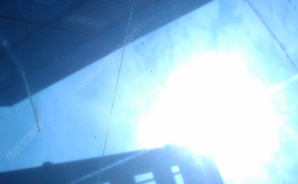 陽光對眼睛的傷害大嗎？紫外線損傷眼睛怎麼辦？(2)