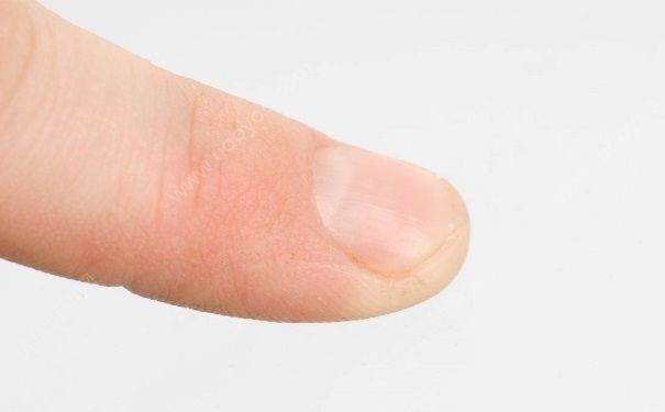 指甲剪太短疼怎麼辦？指甲太短有什麼危害？(3)