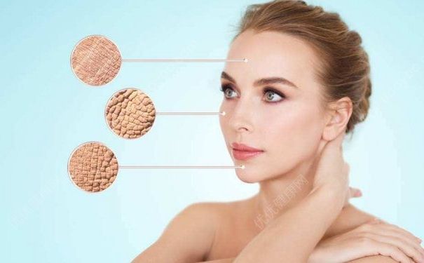 冬季皮膚幹燥該怎麼辦？冬季如何緩解皮膚幹燥？(2)