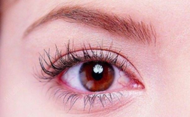 眼睛紅血絲嚴重怎麼辦？為什麼眼睛會有紅血絲？(2)