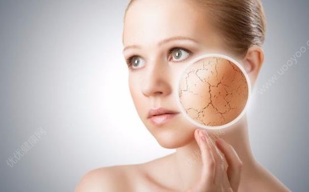 冬天皮膚幹燥怎麼補水？冬季幹冷如何護膚最好？(2)